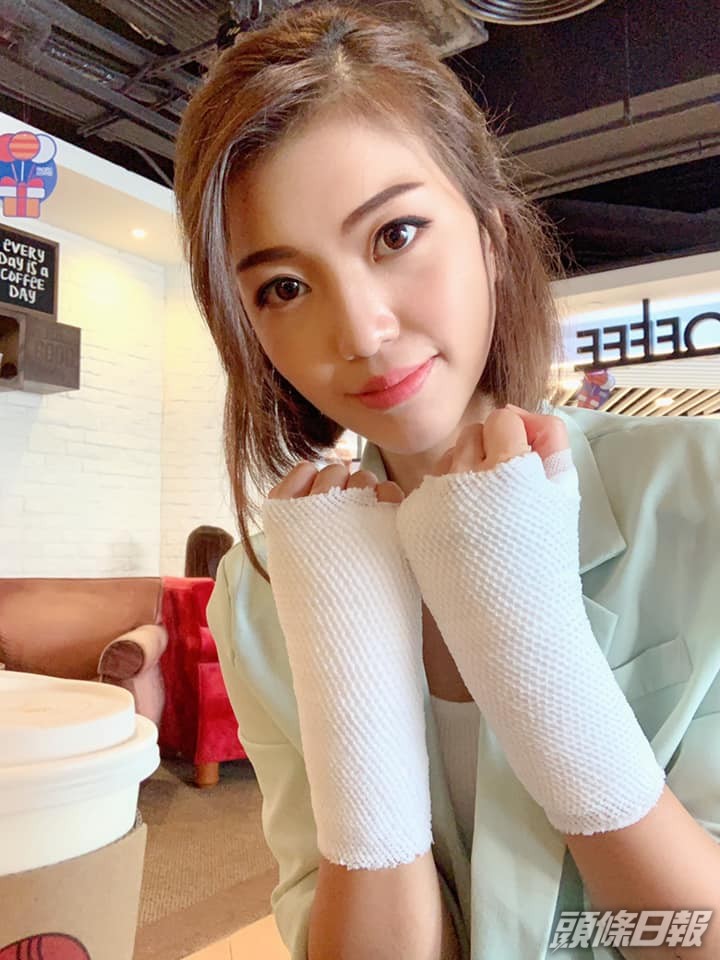 邱芷微患上類風濕關節炎。